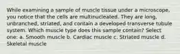 While examining a sample of muscle tissue under a microscope, you notice that the cells are multinucleated. They are long, unbranched, striated, and contain a developed transverse tubule system. Which muscle type does this sample contain? Select one: a. Smooth muscle b. Cardiac muscle c. Striated muscle d. Skeletal muscle