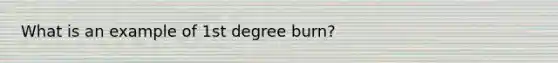 What is an example of 1st degree burn?