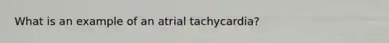 What is an example of an atrial tachycardia?