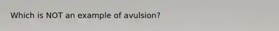 Which is NOT an example of avulsion?