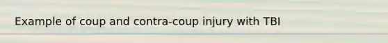 Example of coup and contra-coup injury with TBI