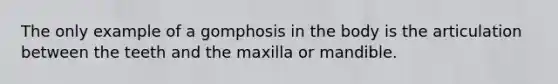 The only example of a gomphosis in the body is the articulation between the teeth and the maxilla or mandible.