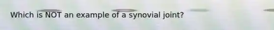 Which is NOT an example of a synovial joint?