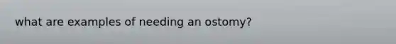 what are examples of needing an ostomy?