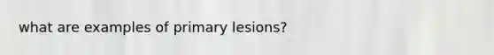 what are examples of primary lesions?