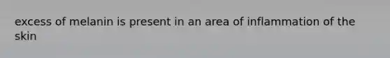 excess of melanin is present in an area of inflammation of the skin