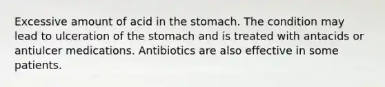 Excessive amount of acid in the stomach. The condition may lead to ulceration of the stomach and is treated with antacids or antiulcer medications. Antibiotics are also effective in some patients.