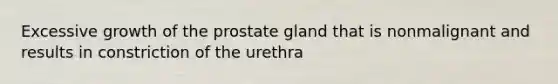 Excessive growth of the prostate gland that is nonmalignant and results in constriction of the urethra