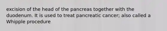 excision of the head of the pancreas together with the duodenum. It is used to treat pancreatic cancer; also called a Whipple procedure