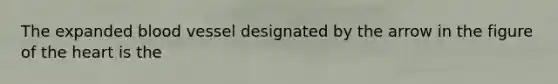 The expanded blood vessel designated by the arrow in the figure of the heart is the