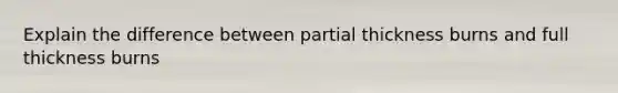 Explain the difference between partial thickness burns and full thickness burns