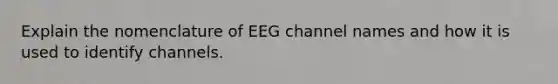 Explain the nomenclature of EEG channel names and how it is used to identify channels.