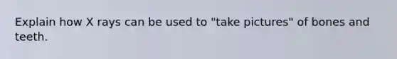 Explain how X rays can be used to "take pictures" of bones and teeth.