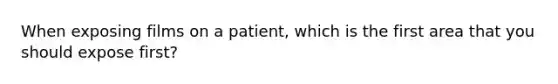 When exposing films on a patient, which is the first area that you should expose first?