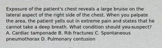 Exposure of the patient's chest reveals a large bruise on the lateral aspect of the right side of the chest. When you palpate the area, the patient yells out in extreme pain and states that he cannot take a deep breath. What condition should you suspect? A. Cardiac tamponade B. Rib fractures C. Spontaneous pneumothorax D. Pulmonary contusion