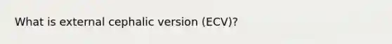 What is external cephalic version (ECV)?