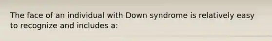 The face of an individual with Down syndrome is relatively easy to recognize and includes a: