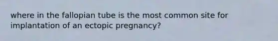 where in the fallopian tube is the most common site for implantation of an ectopic pregnancy?