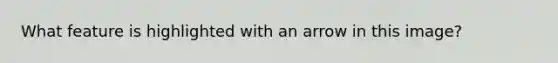 What feature is highlighted with an arrow in this image?
