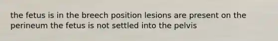 the fetus is in the breech position lesions are present on the perineum the fetus is not settled into the pelvis