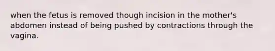 when the fetus is removed though incision in the mother's abdomen instead of being pushed by contractions through the vagina.