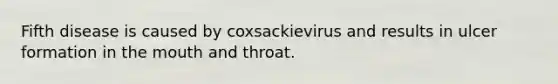 Fifth disease is caused by coxsackievirus and results in ulcer formation in the mouth and throat.