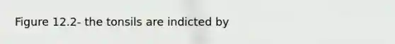 Figure 12.2- the tonsils are indicted by