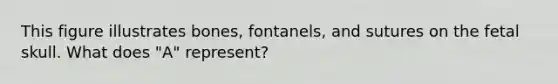 This figure illustrates bones, fontanels, and sutures on the fetal skull. What does "A" represent?