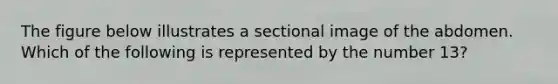 The figure below illustrates a sectional image of the abdomen. Which of the following is represented by the number 13?