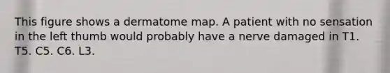 This figure shows a dermatome map. A patient with no sensation in the left thumb would probably have a nerve damaged in T1. T5. C5. C6. L3.