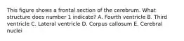 This figure shows a frontal section of the cerebrum. What structure does number 1 indicate? A. Fourth ventricle B. Third ventricle C. Lateral ventricle D. Corpus callosum E. Cerebral nuclei