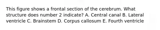 This figure shows a frontal section of the cerebrum. What structure does number 2 indicate? A. Central canal B. Lateral ventricle C. Brainstem D. Corpus callosum E. Fourth ventricle