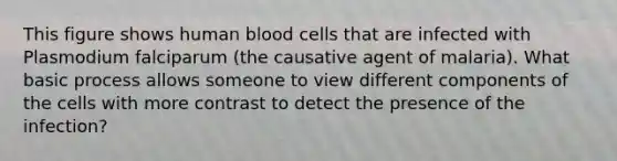 This figure shows human blood cells that are infected with Plasmodium falciparum (the causative agent of malaria). What basic process allows someone to view different components of the cells with more contrast to detect the presence of the infection?