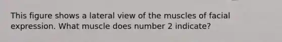 This figure shows a lateral view of the muscles of facial expression. What muscle does number 2 indicate?