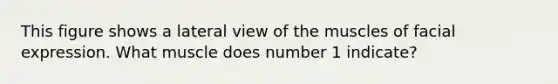 This figure shows a lateral view of the muscles of facial expression. What muscle does number 1 indicate?