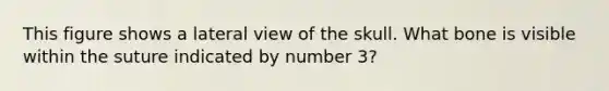 This figure shows a lateral view of the skull. What bone is visible within the suture indicated by number 3?