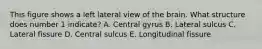 This figure shows a left lateral view of the brain. What structure does number 1 indicate? A. Central gyrus B. Lateral sulcus C. Lateral fissure D. Central sulcus E. Longitudinal fissure