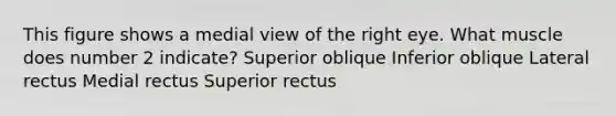 This figure shows a medial view of the right eye. What muscle does number 2 indicate? Superior oblique Inferior oblique Lateral rectus Medial rectus Superior rectus