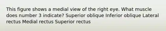 This figure shows a medial view of the right eye. What muscle does number 3 indicate? Superior oblique Inferior oblique Lateral rectus Medial rectus Superior rectus