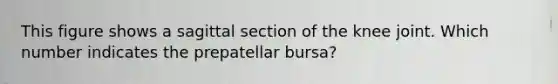 This figure shows a sagittal section of the knee joint. Which number indicates the prepatellar bursa?