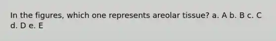 In the figures, which one represents areolar tissue? a. A b. B c. C d. D e. E