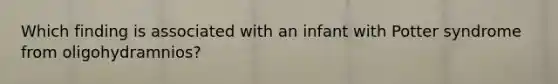 Which finding is associated with an infant with Potter syndrome from oligohydramnios?