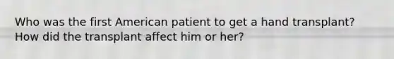 Who was the first American patient to get a hand transplant? How did the transplant affect him or her?