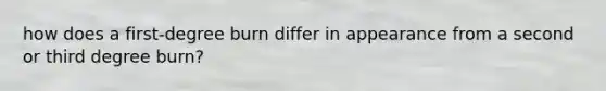 how does a first-degree burn differ in appearance from a second or third degree burn?