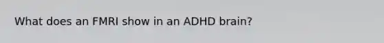 What does an FMRI show in an ADHD brain?