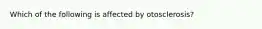 Which of the following is affected by otosclerosis?