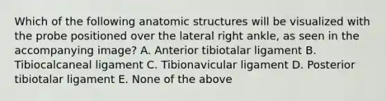 Which of the following anatomic structures will be visualized with the probe positioned over the lateral right ankle, as seen in the accompanying image? A. Anterior tibiotalar ligament B. Tibiocalcaneal ligament C. Tibionavicular ligament D. Posterior tibiotalar ligament E. None of the above