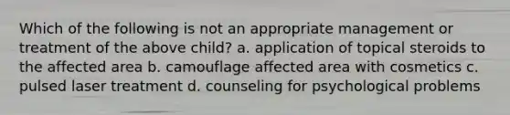 Which of the following is not an appropriate management or treatment of the above child? a. application of topical steroids to the affected area b. camouflage affected area with cosmetics c. pulsed laser treatment d. counseling for psychological problems