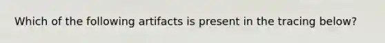 Which of the following artifacts is present in the tracing below?
