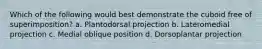 Which of the following would best demonstrate the cuboid free of superimposition? a. Plantodorsal projection b. Lateromedial projection c. Medial oblique position d. Dorsoplantar projection